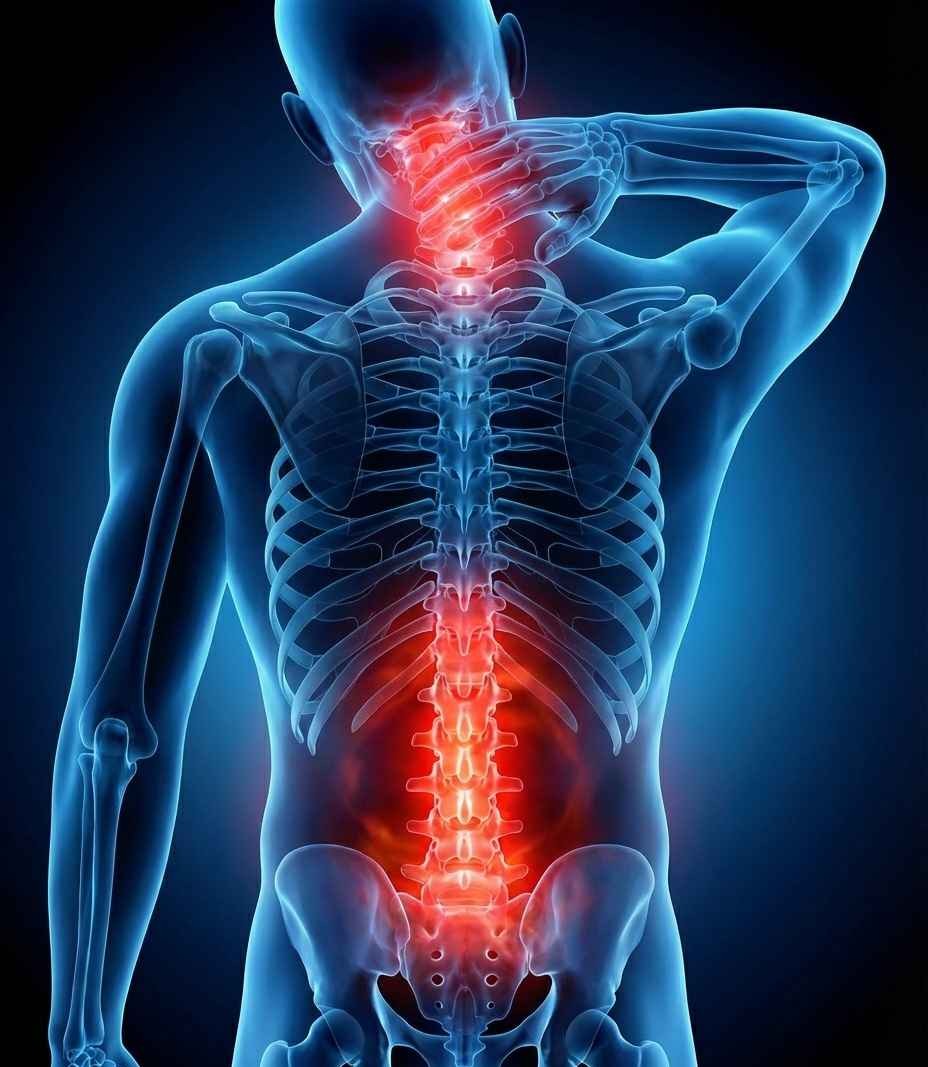 Ilustracija boli u vratu i kralježnici